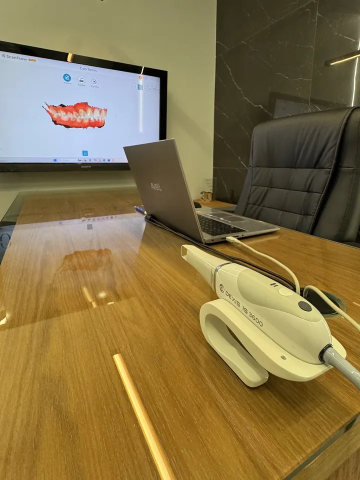 Mesa de planejamento com scanner intraoral